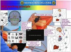 NLS Matrix Decoder Energetic Health & Wellness Demo With Q&A